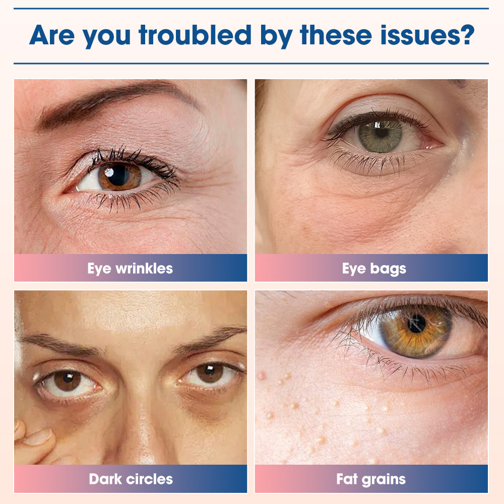 EMS Eye Beauty Device